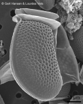 Dinophysis fortii Dinophysis fortii