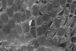 Cheilostomatida