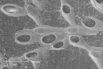 Pyripora catenularia (Fleming, 1828) Pyripora catenularia (Fleming, 1828)