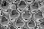 Bryozoa (moss animals)