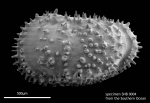 Echinocythereis