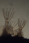 Ctenostomatida