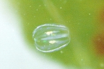 Ctenophora (Sea gooseberries)