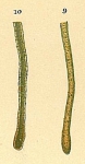 Hyperammina laevigata