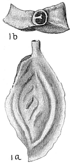 Spiroloculina grateloupi