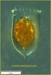 Acanthostomella norvegica Kofoid & Campbell, 1929 Acanthostomella norvegica Kofoid & Campbell, 1929