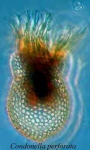 Codonella perforata Entz Sr., 1884 Codonella perforata Entz Sr., 1884