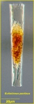 Eutintinnus pectinis (Kofoid & Campbell, 1929) Eutintinnus pectinis (Kofoid & Campbell, 1929)