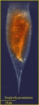 Parafavella parumdentata (Brandt, 1906) Parafavella parumdentata (Brandt, 1906)