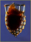 Dictyocysta mitra Haeckel, 1873 Dictyocysta mitra Haeckel, 1873