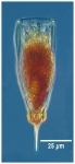 Parundella inflata Kofoid & Campbell, 1929 AphiaID: 417256 Parundella inflata Kofoid & Campbell, 1929 AphiaID: 417256
