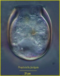 Proplectella fastigata Jörgensen, 1924 Proplectella fastigata Jörgensen, 1924