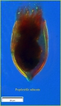 Proplectella subacuta Kofoid & Campbell, 1929 Proplectella subacuta Kofoid & Campbell, 1929