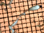 Siphonophorae Siphonophorae