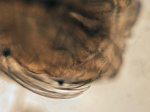 Chaetognatha (arrow worms)