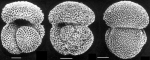 Globigerinoides conglobatus