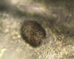 Protozoa (other)