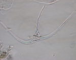 Ceratium