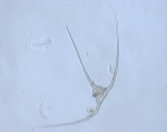 Ceratium