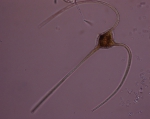 Ceratium