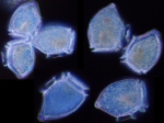 Dinophysis norvegica