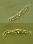 Protozoa (other)