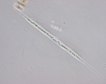Rhizosolenia setigera