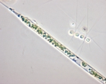 Rhizosolenia setigera