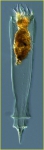 Xystonellopsis paradoxa Xystonellopsis paradoxa