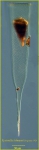 Xystonella lohmanni Xystonella lohmanni