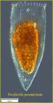 Parafavella parumdentata Parafavella parumdentata