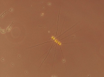 Chaetoceros similis