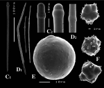 Paratimea globastrella spicules Paratimea globastrella spicules