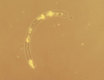 Guinardia striata