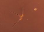 Asterionellopsis glacialis
