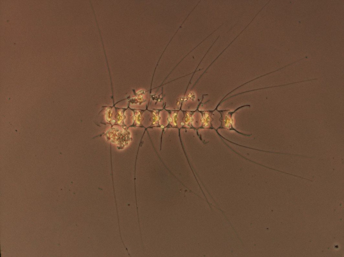 Chaetoceros didymus Chaetoceros didymus