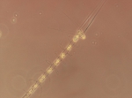 Chaetoceros laciniosus