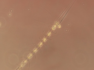 Chaetoceros laciniosus