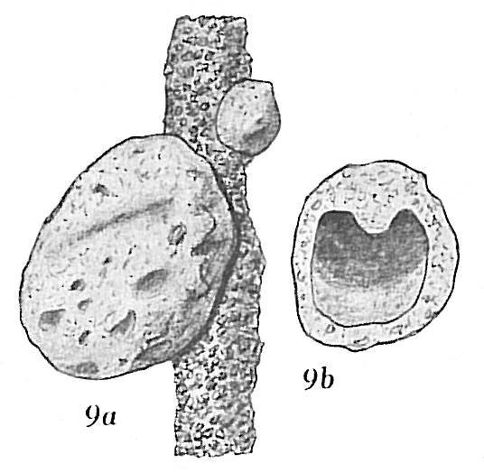 Crithionina mamilla