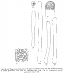 Hyperammina laevigata