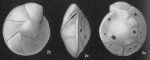 Oridorsalis umbonatus