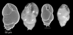 Bulimina aculeata d´Orbigny, 1826
