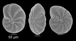 Elphidium excavatum (Terquem, 1875) Elphidium excavatum (Terquem, 1875)