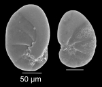 Nonionella stella Cushman & Moyer, 1930