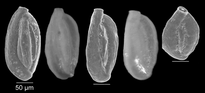 Quinqueloculina stelligera Schlumberger, 1893