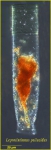 Leprotintinnus pellucidue