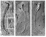 Limipolycystis falx Limipolycystis falx