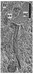 Limipolycystis friedae Limipolycystis friedae