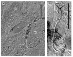 Limipolycystis sicilicula Limipolycystis sicilicula