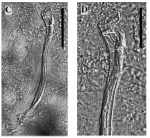 Limipolycystis wallbergi Limipolycystis wallbergi